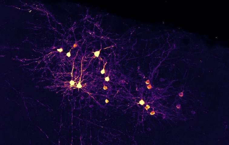 一起放电的神经元并不总是连接在一起