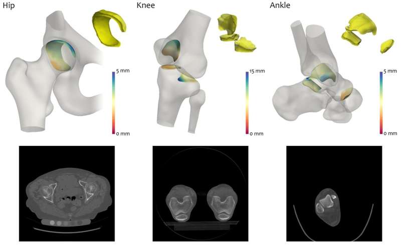 New 3D imaging analysis technique could lead to improved arthritis treatment