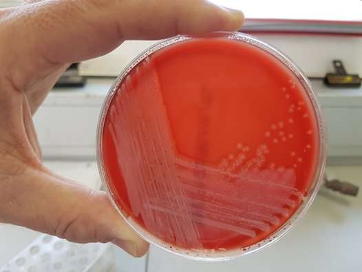 New bacterial strain named after Cornish discovery