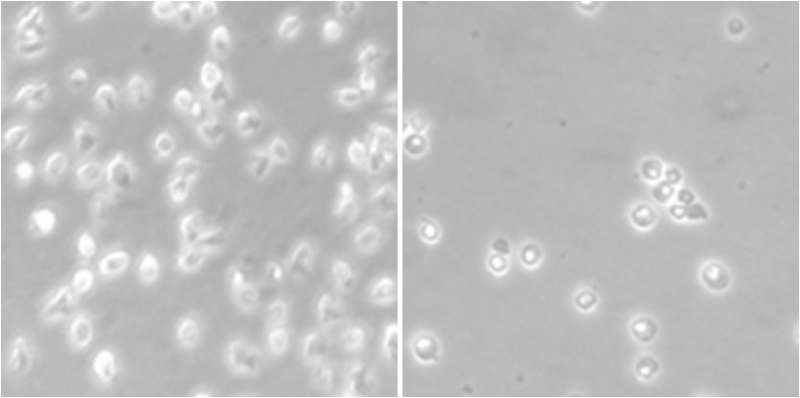 New epigenetic drug against Mantle Cell Lymphoma