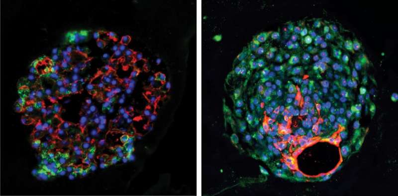 新发现的干细胞有助于再生肺组织在急性损伤后，找到宾夕法尼亚州的研究