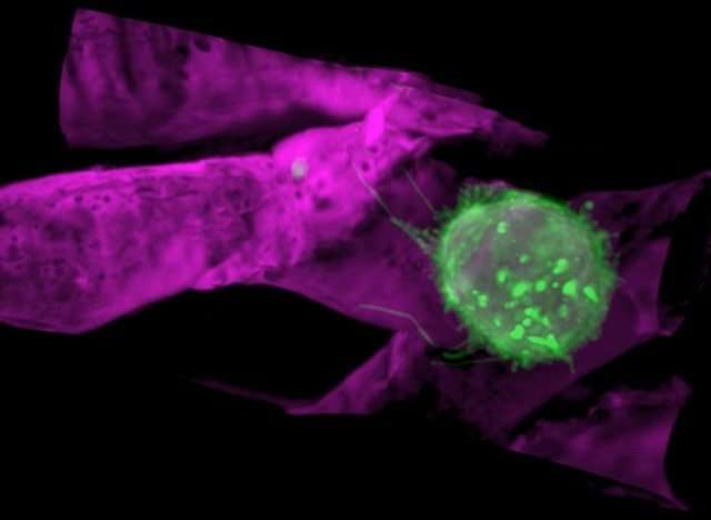 New Imaging Method Identifies How Normal and Cancer Cells Move and Adapt