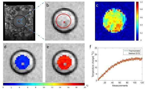 New method improves temperature imaging accuracy in fat-containing tissues