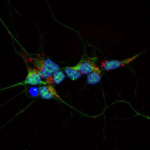 New neuron-like cells allow investigation into synthesis of vital cellular components