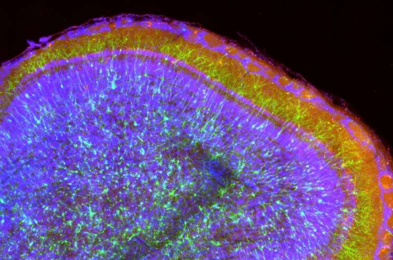 New neurons in the adult brain are involved in sensory learning