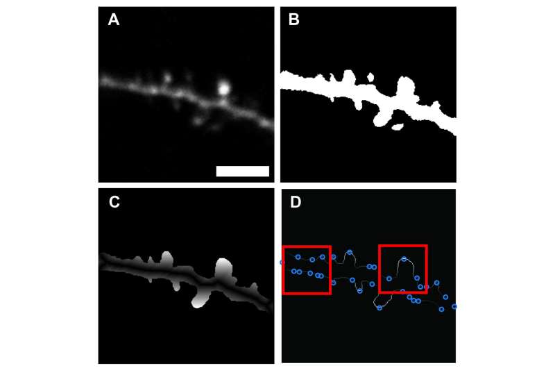 New software designed for rapid, automated identification of dendritic spines