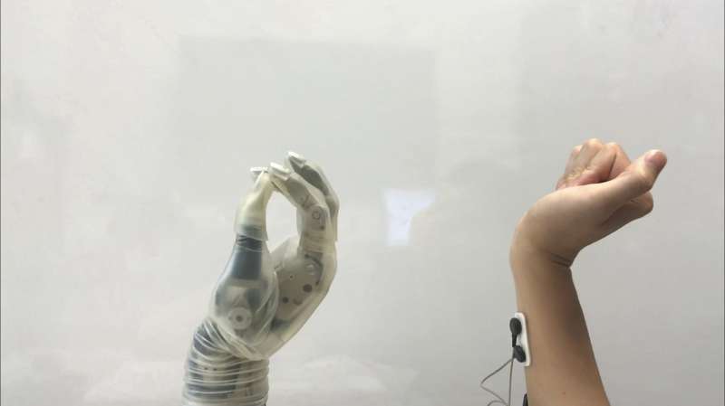 New tech may make prosthetic hands easier for patients to use