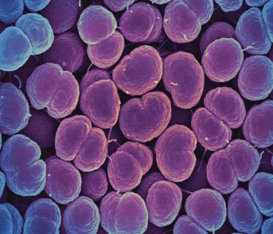 Novel antibiotic shows promise in treatment of uncomplicated gonorrhea