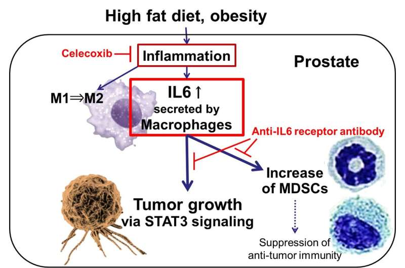 Obesity and inflammation – a deadly combination for prostate cancer