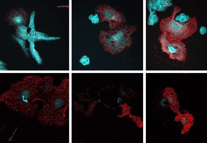 Ovarian cancer cells switched off by 'unusual' mechanism