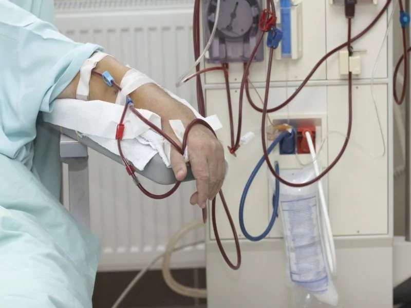 Patients report poorer dialysis service in certain settings