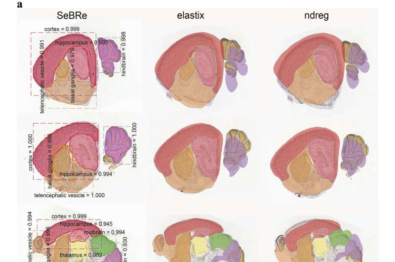 Performance comparison of SeBRe with commonly used brain registration methods. Credit: Theofanis Karayannis et al.