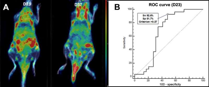 PET imaging agent could provide early diagnosis of rheumatoid arthritis