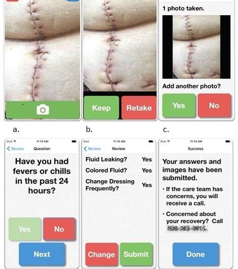 Postoperative wound monitoring app can reduce readmissions and improve patient care