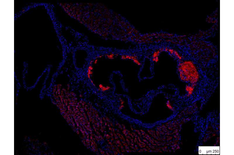 Protective mechanism against atherosclerosis discovered