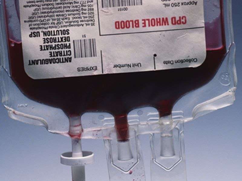 RBC, plasma transfusions drop from 2011 to 2014