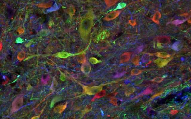 Reprogrammed stem cell-derived neurons survive long-term in pigs with spinal cord injuries
