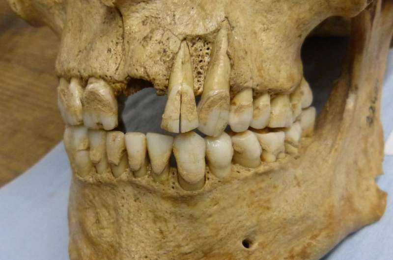 Research on British teeth unlocks potential for new insights into ancient diets