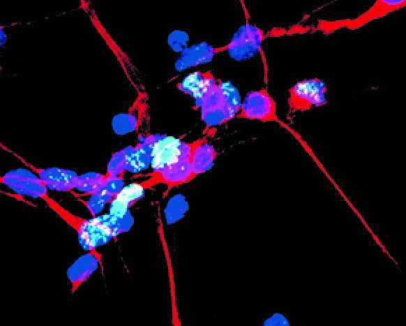 Road to cell death more clearly identified for Parkinson's disease