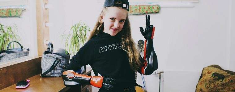 Robotics startup launches first medically approved 3-D printed bionic arms