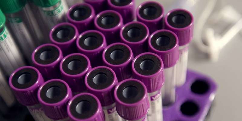 Simple blood test could reveal epilepsy risk