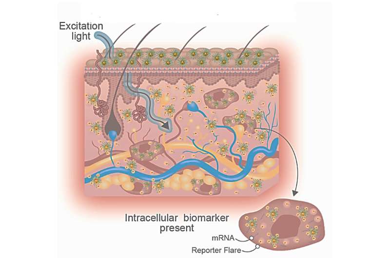 Simplifying skin disease diagnosis with topical nanotechnology