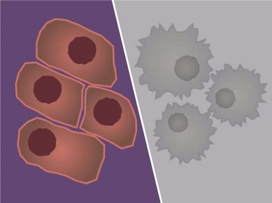 Single-cell analysis reveals how melanoma cells resist immunotherapy