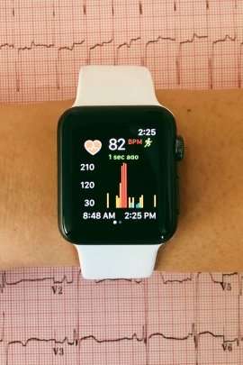 Smartwatch effective in detecting atrial fibrillation