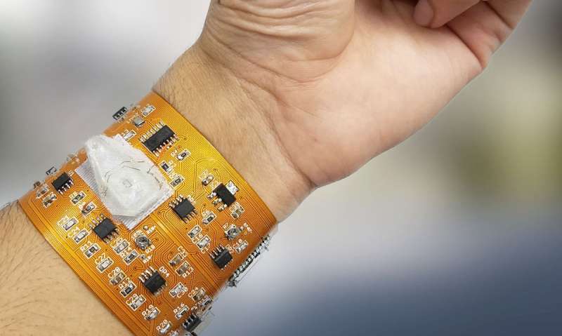 Smart wristband with link to smartphones could monitor health, environmental exposures