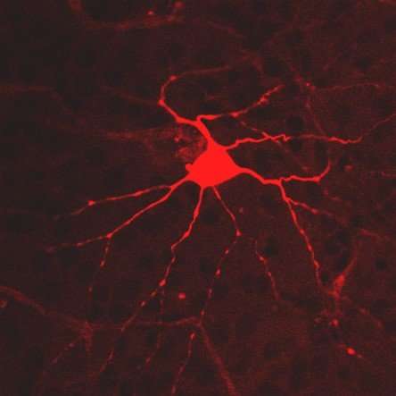 Some of retina's light-sensing cells may have ancient roots