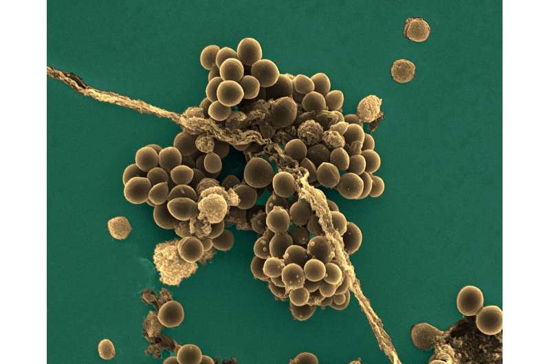 Staphylococcus aureus: A new mechanism involved in virulence and antibiotic resistance