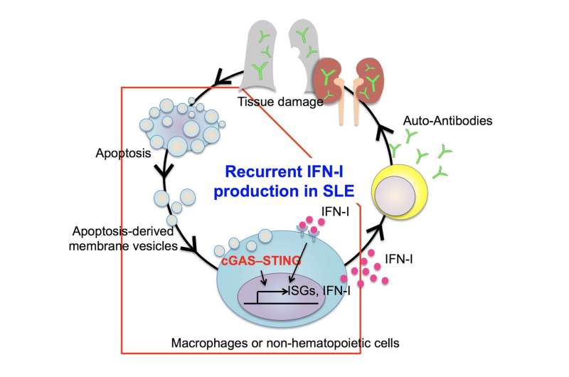 Step-by-step account of systemic lupus erythematosus development revealed