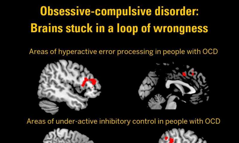 Stuck in a loop of wrongness: Brain study shows roots of OCD
