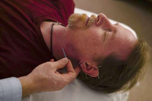 Stuck in an opioids crisis, officials turn to acupuncture