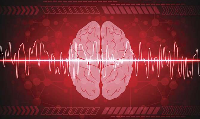 Study backs up connection between atrial fibrillation and dementia