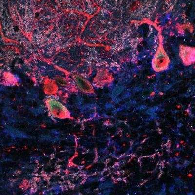 Study of protein 'trafficker' provides insight into autism and other brain disorders