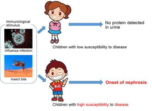 Susceptible genes identified for childhood chronic kidney disease