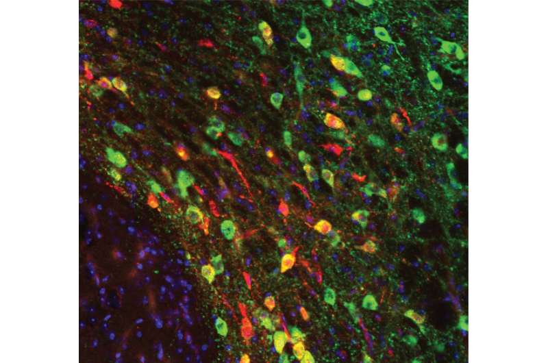 Synapses of the reward system at stake in autistic disorders