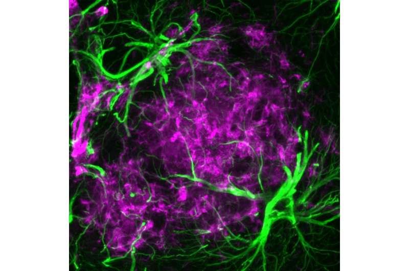 The brain's 'rising stars': New options against Alzheimer's?