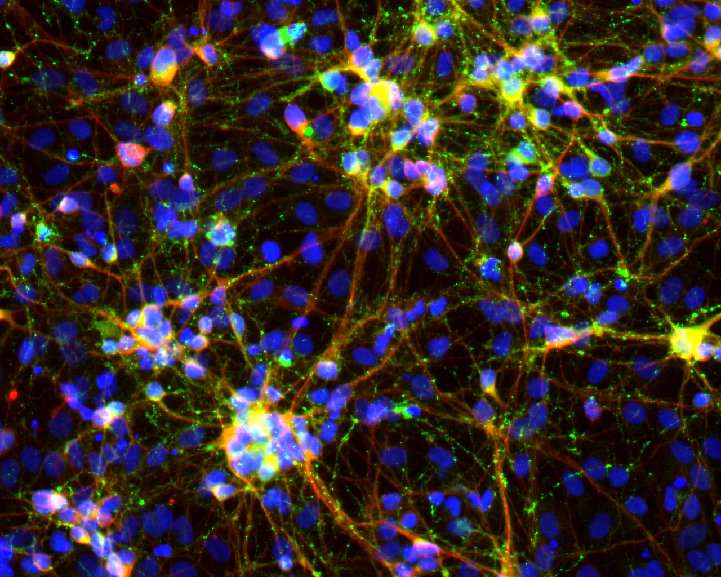The joy of neurons: A simplified 'cookbook' for engineering brain cells to study disease