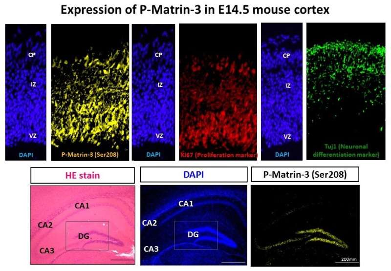 The protein Matrin-3 determines the fate of neural stem cells in brain development