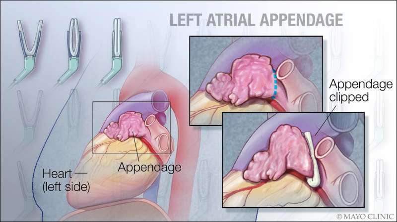 To have or not to have... your left atrial appendage closed