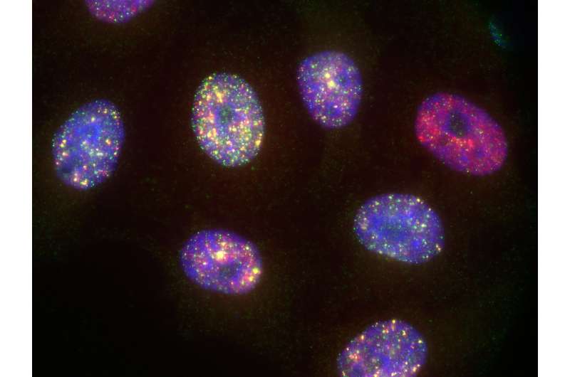 Tracing the footprints of a tumor: Genomic 'scars' allow cancer profiling
