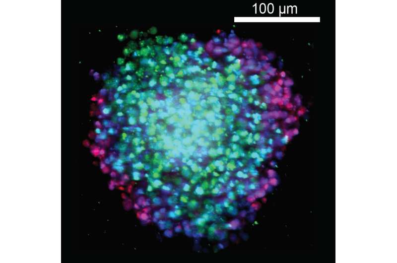 Tumor-like spheres help scientists discover smarter cancer drugs