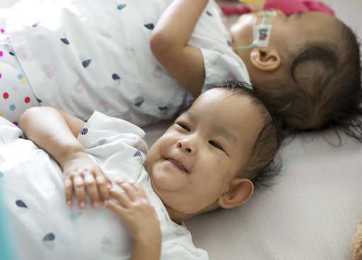 Twins separated by surgery are healing, sticking together