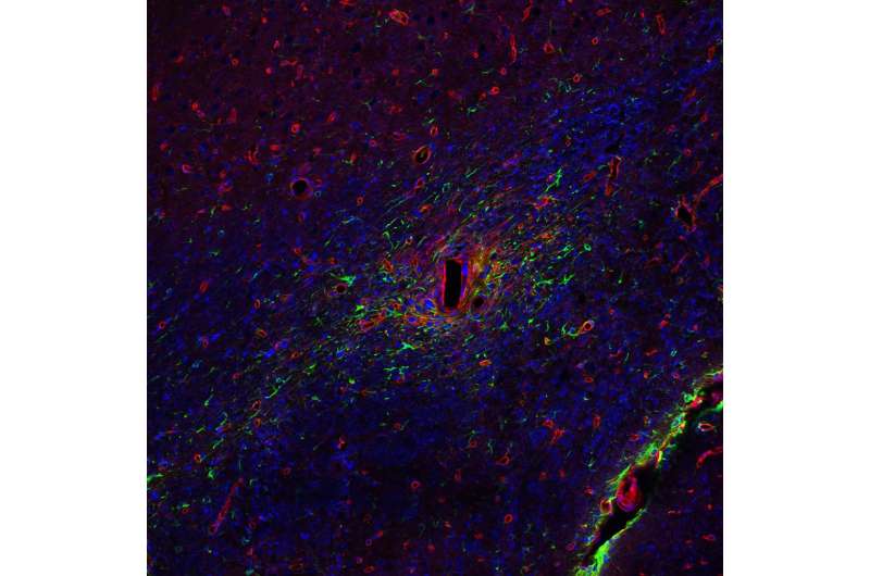 Uncovering the power of glial cells