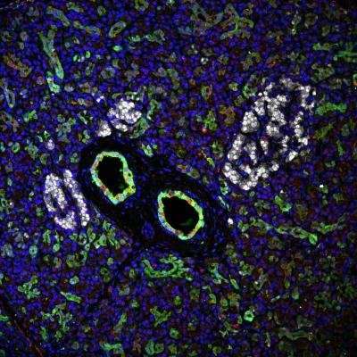 Unique pancreatic stem cells have potential to regenerate beta cells, respond to glucose