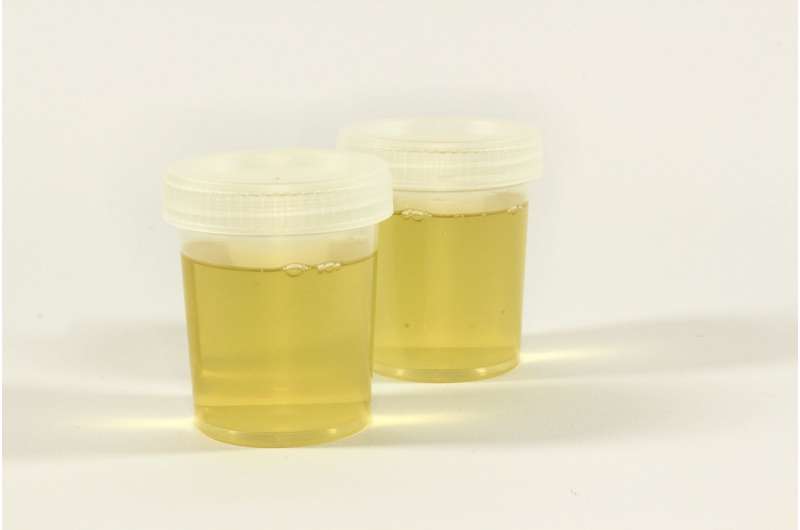 teste de urina