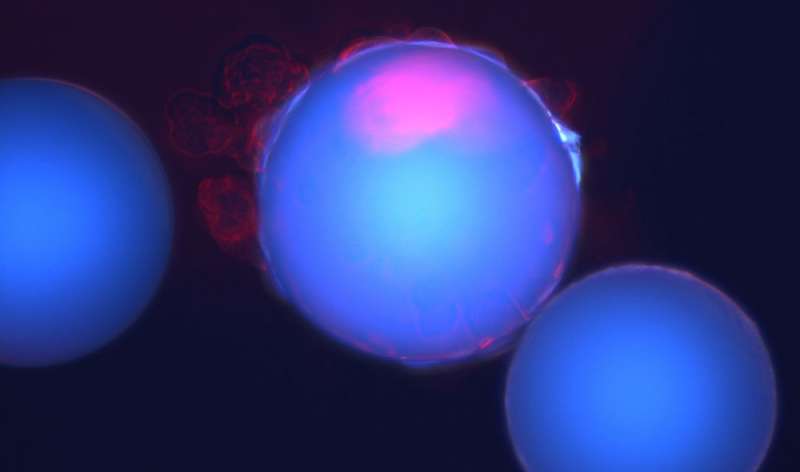UT Dallas scientists isolate cancer stem cells using novel method