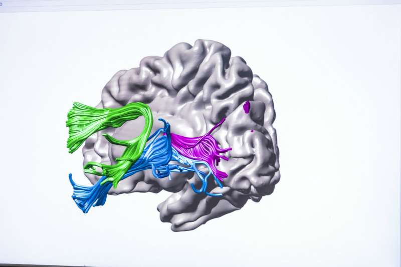 UW study shows how instruction changes brain circuitry in